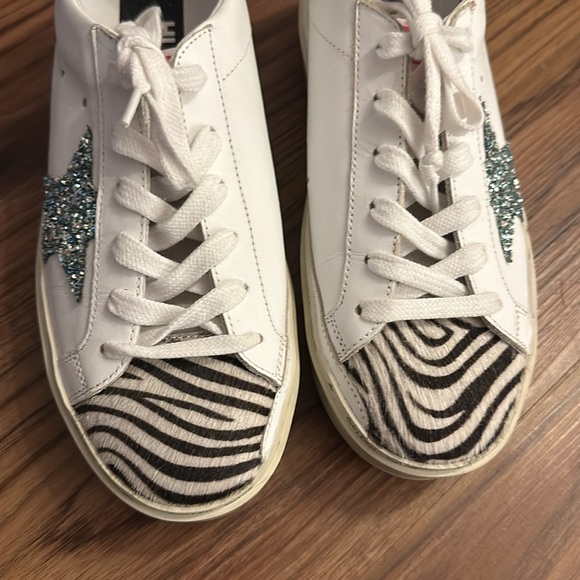 Golden Goose All Hi Star Sneakers with Light Blue Glitter Star and Zebra Print - Picture 10 of 11